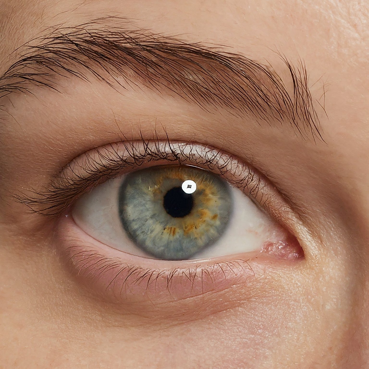 LASIK MATA